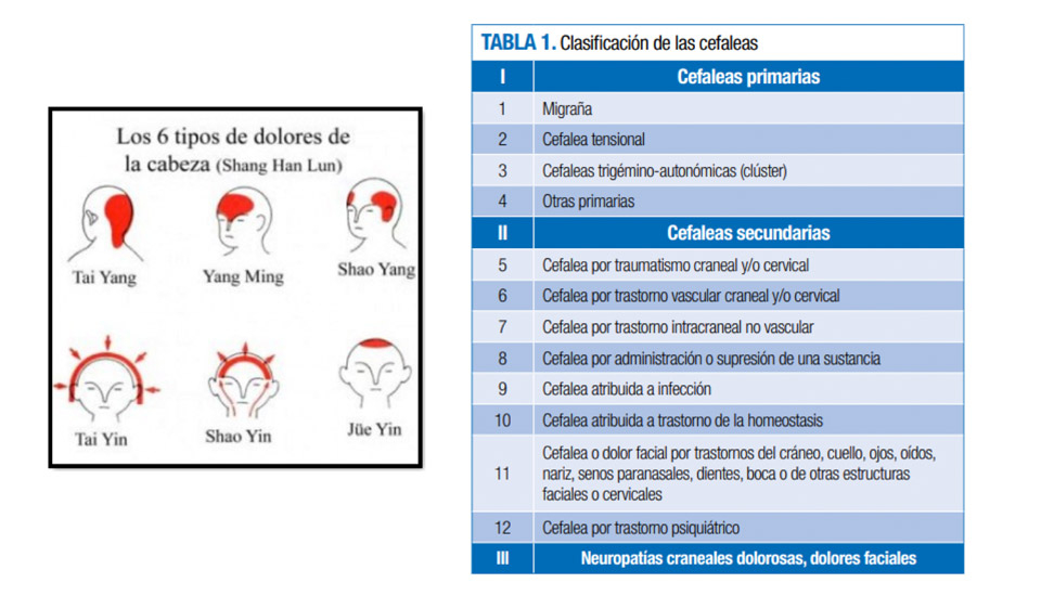 medicina china y cefaleas